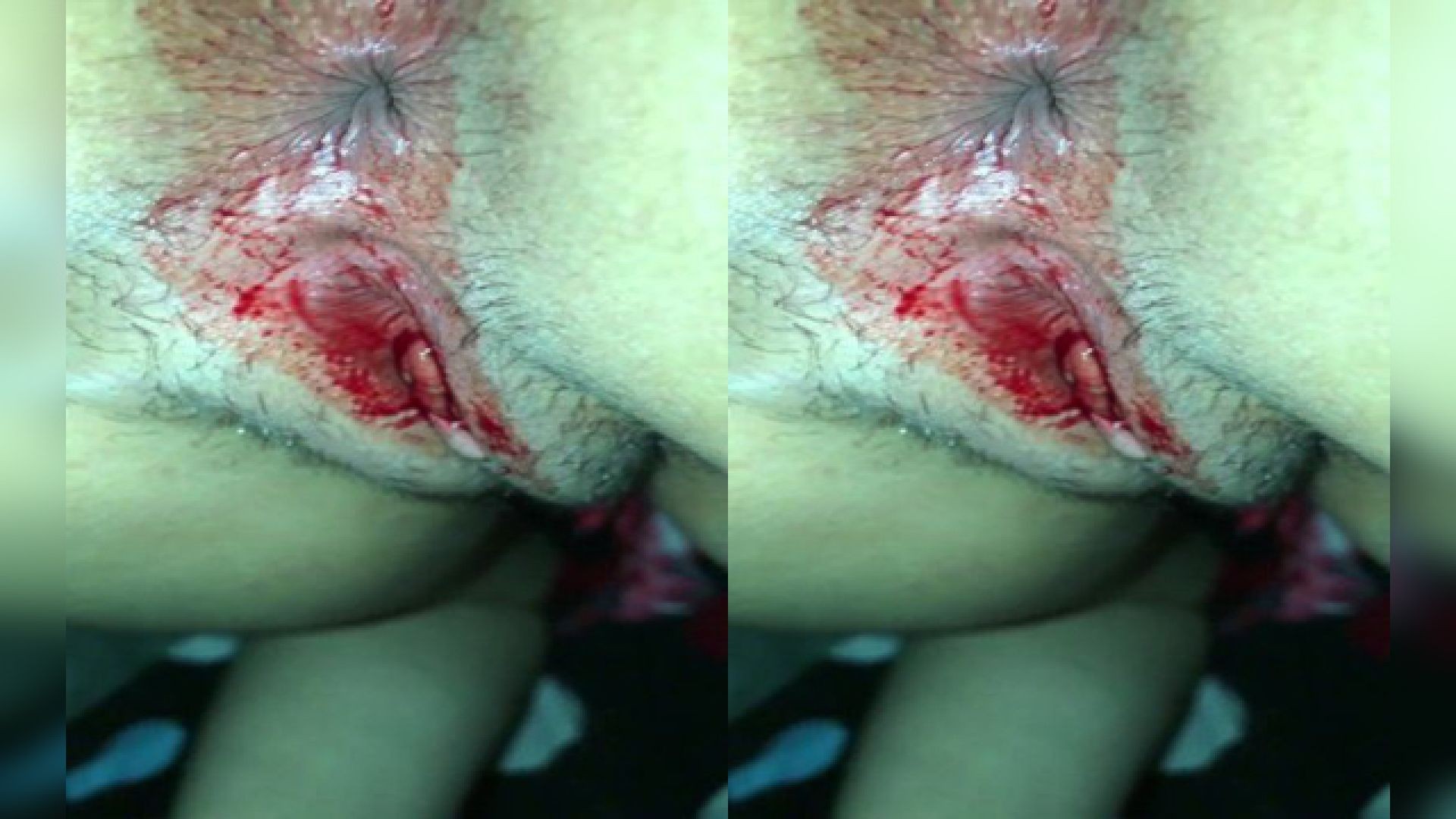 Today Exclusive- BF BREAK SEL OF YOUNG GIRL & MAKE VIDEO